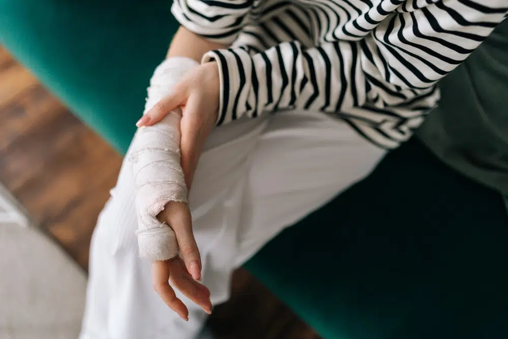 Injured Hand Photo of Injured Hands
